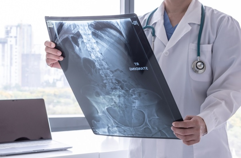 Conheça mais sobre o curso Técnico em Radiologia da Esamaztec
